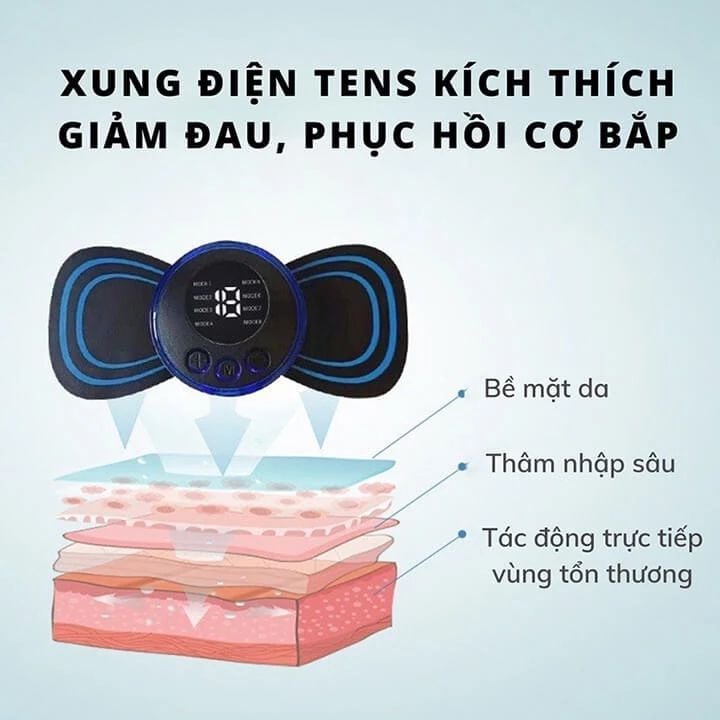 Công nghệ TENS